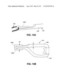 VARIABLE DENIER YARN AND SUTURE diagram and image