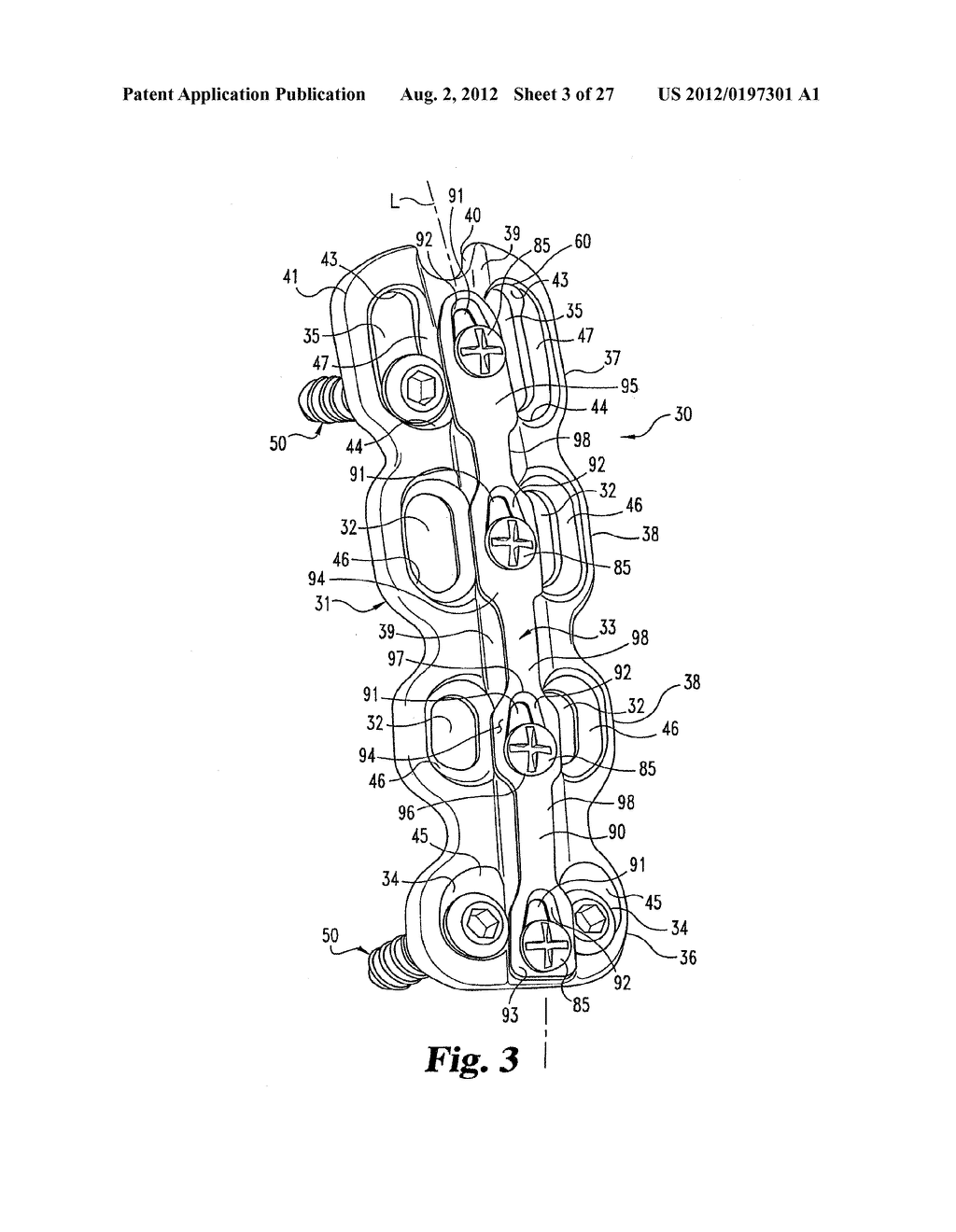 SYSTEM AND METHOD FOR SECURING A PLATE TO THE SPINAL COLUMN - diagram, schematic, and image 04