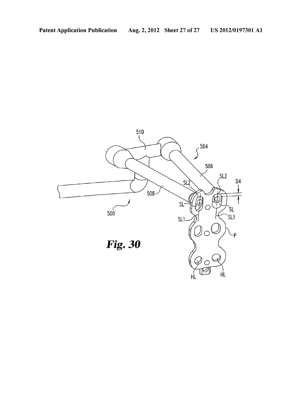 SYSTEM AND METHOD FOR SECURING A PLATE TO THE SPINAL COLUMN - diagram, schematic, and image 28