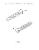 BONE FIXATION SYSTEM diagram and image