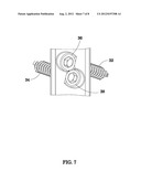 BONE FIXATION SYSTEM diagram and image