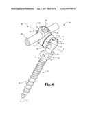 Bone Anchor Including an Elongate Post With Break-Off Features diagram and image