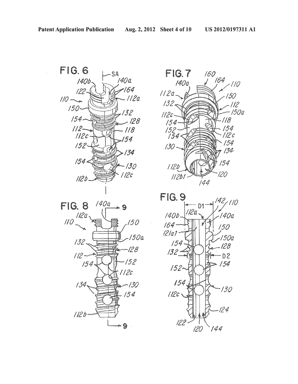 MINIMALLY INVASIVE SPINAL FACET COMPRESSION SCREW AND SYSTEM FOR BONE     JOINT FUSION AND FIXATION - diagram, schematic, and image 05