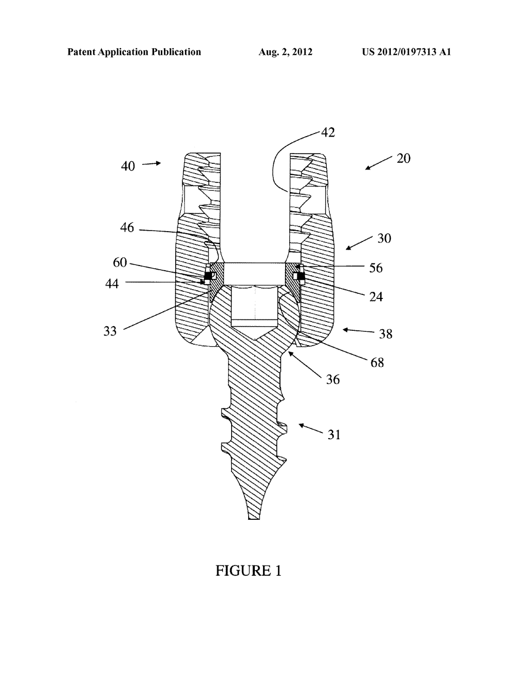 Angled Receiver Wall for Provisionally Fixing a Crown in a Multi-Axial     Screw Assembly - diagram, schematic, and image 02