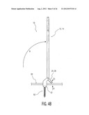 Rod Coercer diagram and image