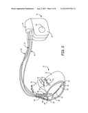 ISOLATED LEAD CONDUCTOR MEASUREMENTS FOR FAULT DETECTION diagram and image