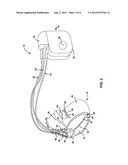 HIGH DIELECTRIC CONSTANT SHEATH MATERIALS FOR IMPLANTABLE MEDICAL DEVICE     LEADS OR CATHETERS diagram and image