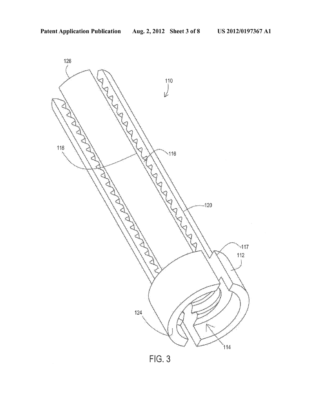 ANCHORS INCLUDING RIGID BODIES DEFINING FULL LENGTH SLOTS FOR USE WITH     IMPLANTABLE MEDICAL LEADS - diagram, schematic, and image 04