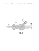 VASCULAR DELIVERY SYSTEM AND METHOD diagram and image