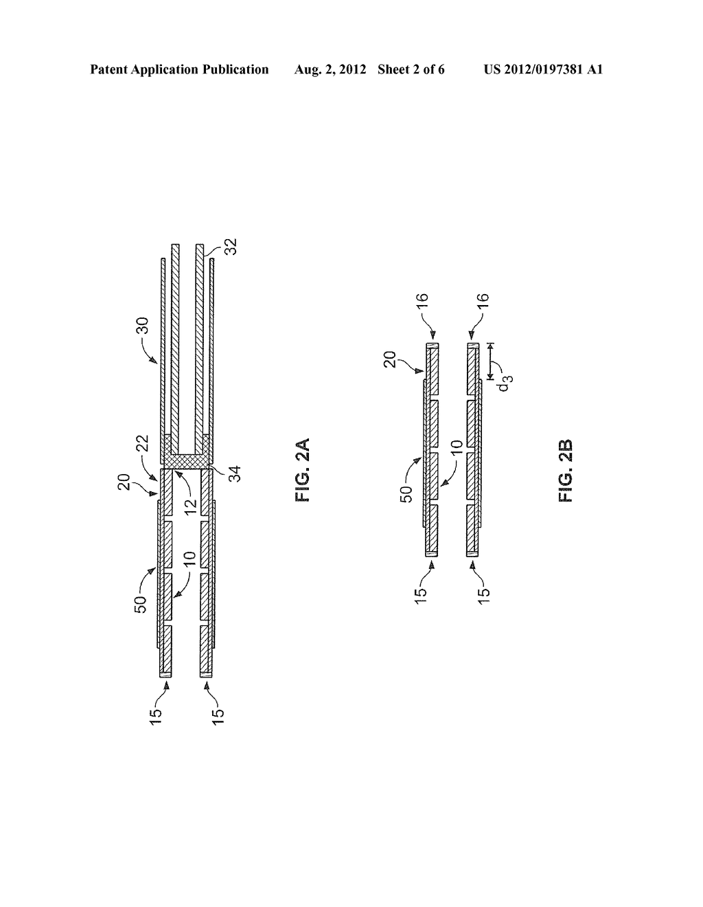 STENT-GRAFT WITH PROXIMAL AND DISTAL ATTACHMENT, DELIVERY CATHETER AND     METHODS OF MAKING SAME - diagram, schematic, and image 03