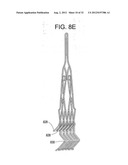 Stent-Valves for Valve Replacement and Associated Methods and Systems for     Surgery diagram and image