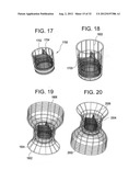 Stent-Valves for Valve Replacement and Associated Methods and Systems for     Surgery diagram and image