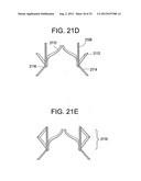 Stent-Valves for Valve Replacement and Associated Methods and Systems for     Surgery diagram and image