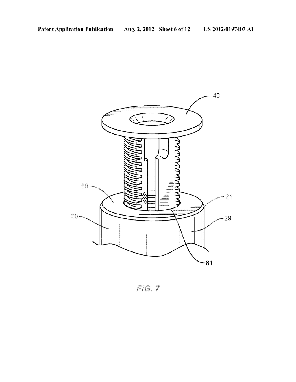 EXPANDABLE MEDICAL IMPLANT - diagram, schematic, and image 07