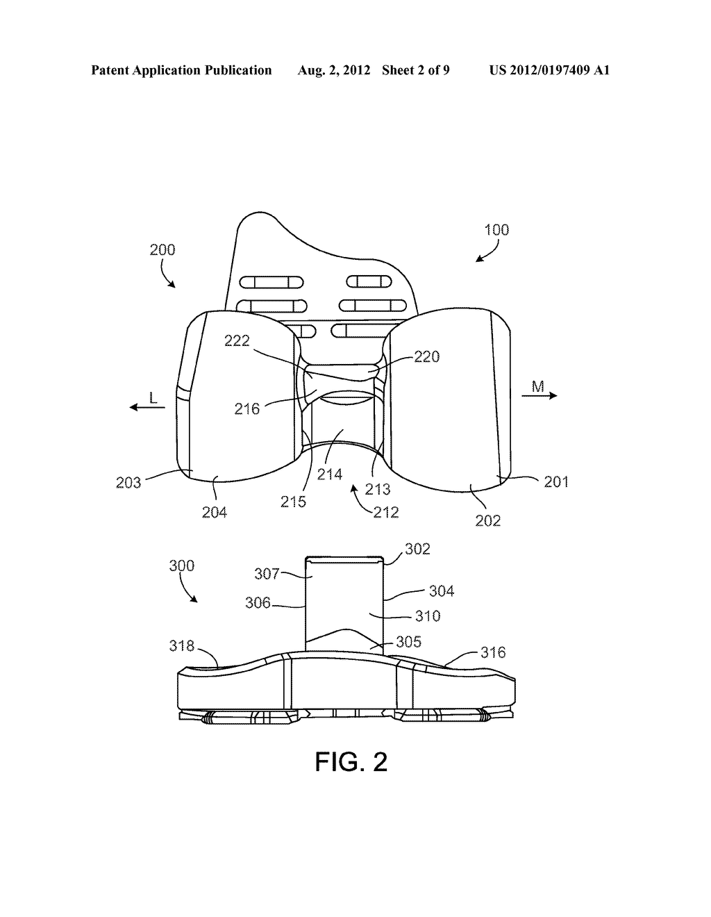 CONSTRAINED KNEE PROSTHESIS - diagram, schematic, and image 03