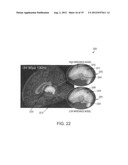 Systems and methods for determining volume of activation for deep brain     stimulation diagram and image