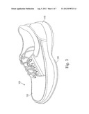 THERAPEUTIC SHOE diagram and image