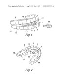 Regulatable Intraoral Mandibular Advancement Device, for Preventing     Snoring and Sleep Apnoea diagram and image