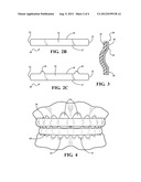 ORTHODONTIC APPLIANCE SHIELD diagram and image