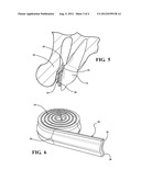 ORTHODONTIC APPLIANCE SHIELD diagram and image