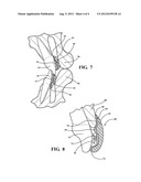 ORTHODONTIC APPLIANCE SHIELD diagram and image