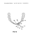 Dental Floss diagram and image