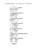 Dental Floss diagram and image