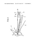 OPHTHALMIC MEASUREMENT DEVICE diagram and image