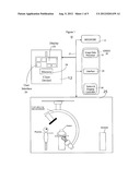 Digital Subtraction Angiography (DSA) Motion Compensated Imaging System diagram and image