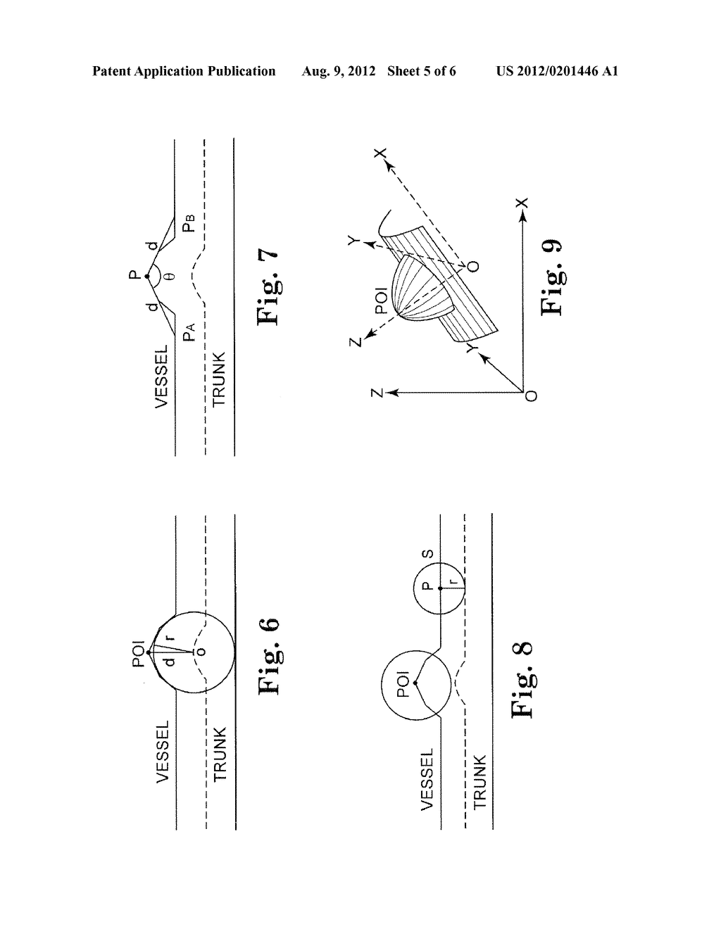 COMPUTER-AIDED DETECTION (CAD) OF INTRACRANIAL ANEURYSMS - diagram, schematic, and image 06