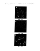 LIPOSOMES COMPRISING A CALCIUM PHOSPHATE-CONTAINING PRECIPITATE diagram and image