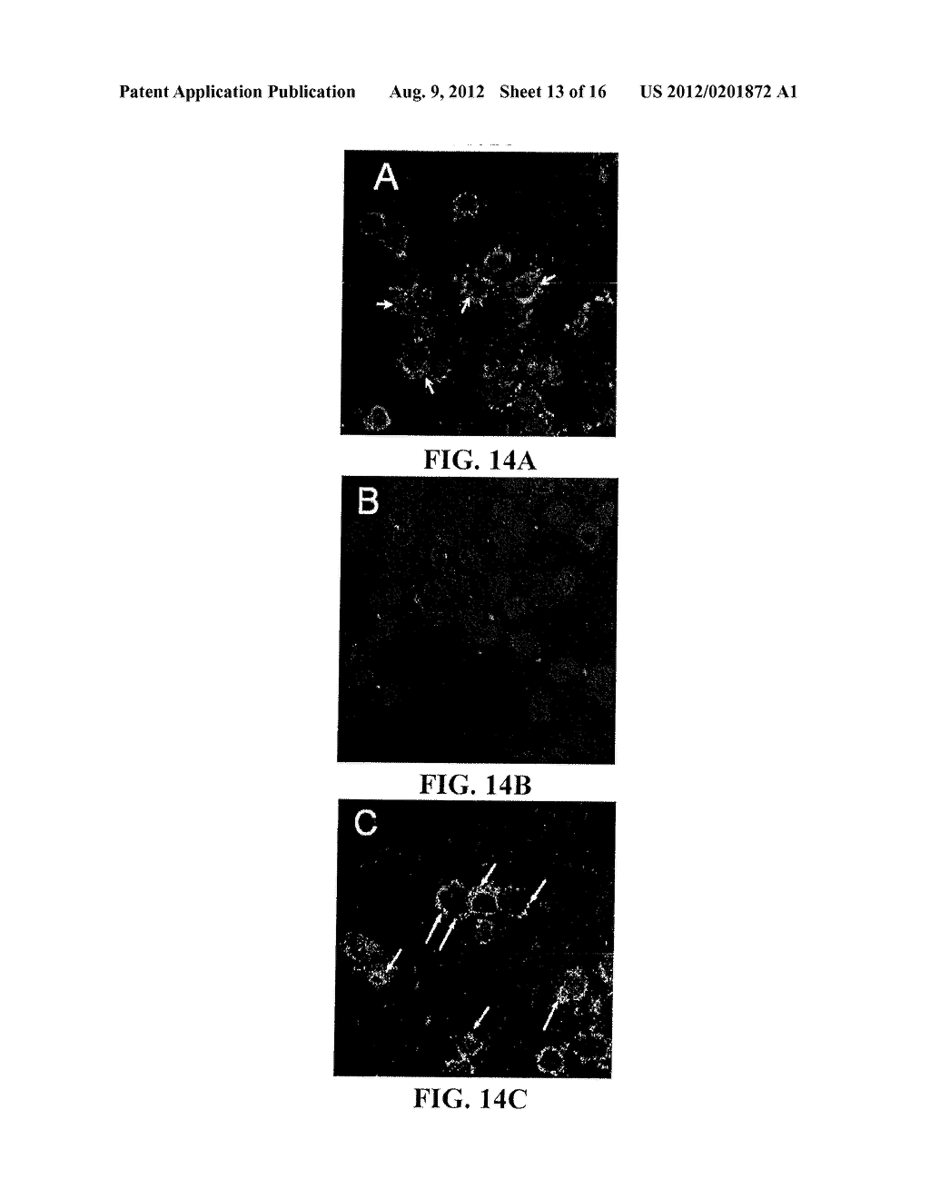 LIPOSOMES COMPRISING A CALCIUM PHOSPHATE-CONTAINING PRECIPITATE - diagram, schematic, and image 14