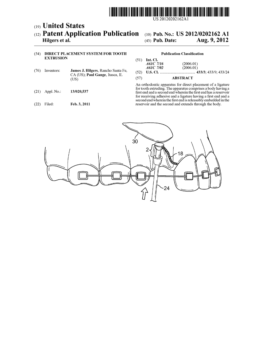 Direct Placement System for Tooth Extrusion - diagram, schematic, and image 01