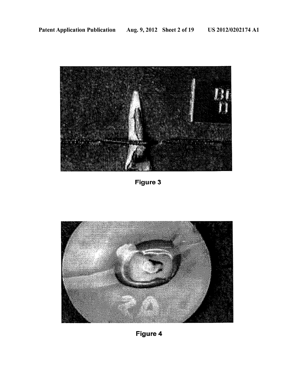 PROCESS FOR LASER TREATMENT OF DENTAL CAVITIES, BIOMATERIAL FOR     REALISATION AND USE THEREOF - diagram, schematic, and image 03