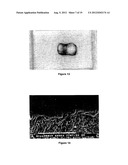 PROCESS FOR LASER TREATMENT OF DENTAL CAVITIES, BIOMATERIAL FOR     REALISATION AND USE THEREOF diagram and image