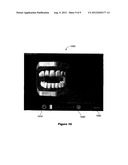 SYSTEMS AND METHODS FOR VERBAL COMMUNICATION FROM A SPEECH IMPAIRED     INDIVIDUAL diagram and image