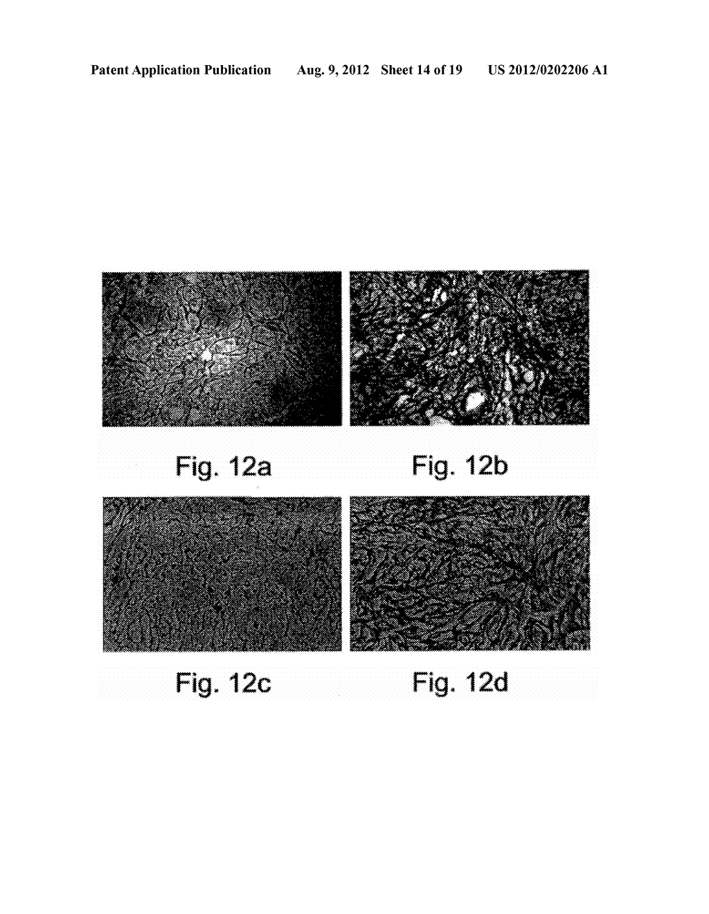 PHARMACEUTICAL COMPOSITIONS AND METHODS USEFUL FOR MODULATING     ANGIOGENESIS, INHIBITING METASTASIS AND TUMOR FIBROSIS, AND ASSESSING THE     MALIGNANCY OF COLON CANCER TUMORS - diagram, schematic, and image 15