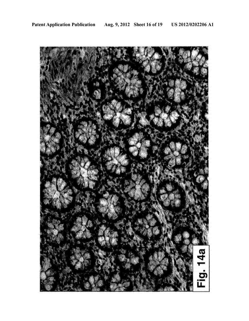 PHARMACEUTICAL COMPOSITIONS AND METHODS USEFUL FOR MODULATING     ANGIOGENESIS, INHIBITING METASTASIS AND TUMOR FIBROSIS, AND ASSESSING THE     MALIGNANCY OF COLON CANCER TUMORS - diagram, schematic, and image 17