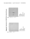 NUCLEIC ACID AND CORRESPONDING PROTEIN ENTITLED 193P1E1B USEFUL IN     TREATMENT AND DETECTION OF CANCER diagram and image