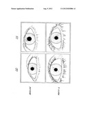 METHOD OF ENHANCING HAIR GROWTH diagram and image