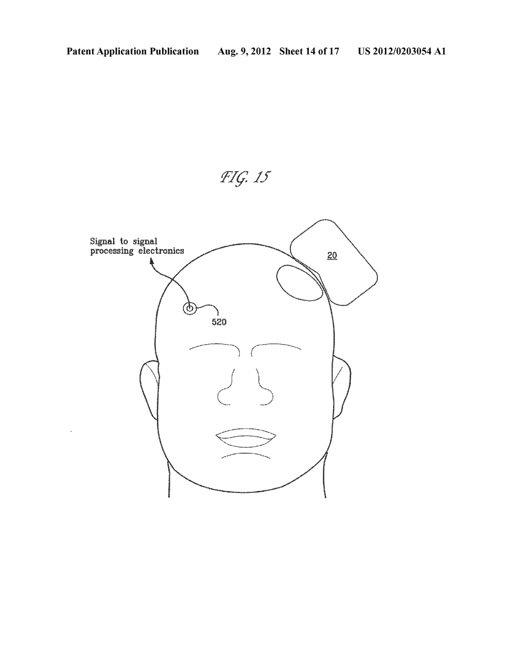 Method and Apparatus for Determining the Proximity of a TMS Coil to a     Subject's Head - diagram, schematic, and image 15