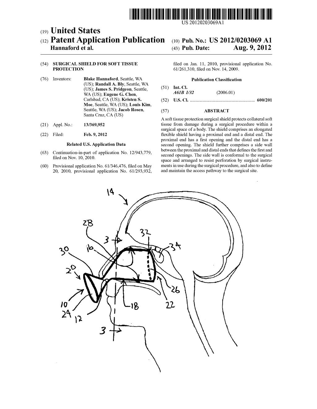 SURGICAL SHIELD FOR SOFT TISSUE PROTECTION - diagram, schematic, and image 01