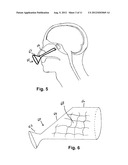 SURGICAL SHIELD FOR SOFT TISSUE PROTECTION diagram and image