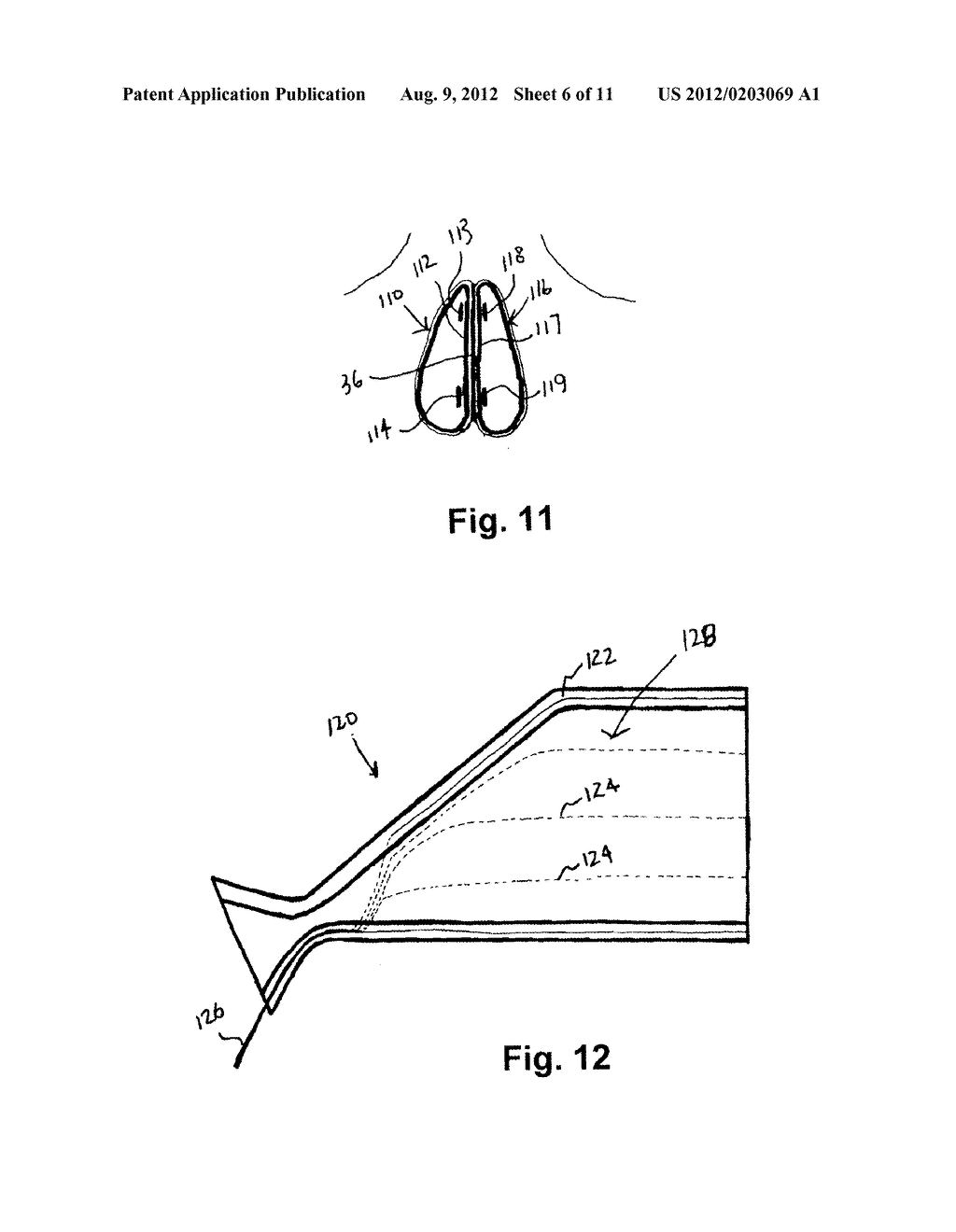 SURGICAL SHIELD FOR SOFT TISSUE PROTECTION - diagram, schematic, and image 07