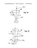 SURGICAL SHIELD FOR SOFT TISSUE PROTECTION diagram and image