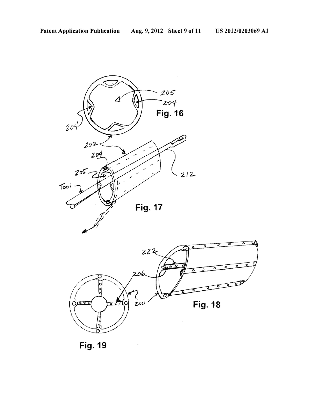 SURGICAL SHIELD FOR SOFT TISSUE PROTECTION - diagram, schematic, and image 10