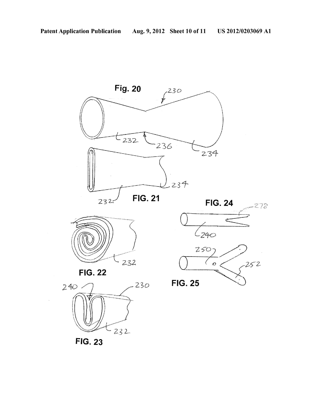 SURGICAL SHIELD FOR SOFT TISSUE PROTECTION - diagram, schematic, and image 11