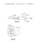 SURGICAL SHIELD FOR SOFT TISSUE PROTECTION diagram and image