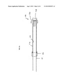 Endoscopic Soft Tissue Working Space Creation diagram and image