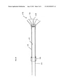 Endoscopic Soft Tissue Working Space Creation diagram and image